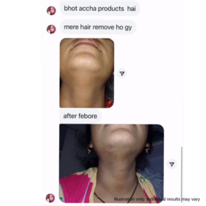 facial hair treatment review